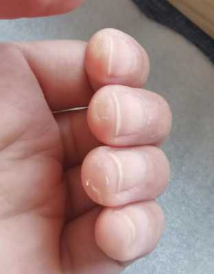 弹吉他为什么手指会痛痛（弹吉他为什么手指疼）